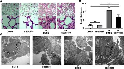 Inhibition of p38 MAPK Mitigates Lung Ischemia Reperfusion Injury by Reducing Blood–Air Barrier Hyperpermeability